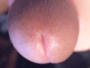 Mon gland (vue frontale) | Ma queue branlée | Détails de mon sexe | Autoportrait | Ma bite, mon amie © David Noir